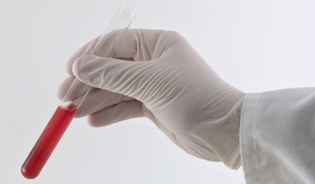 Así es cómo los genes teranósticos mejoran las terapias contra el cáncer: un avance científico