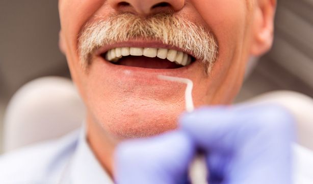 Estos son los peligros de realizarse tratamientos caseros de blanqueamiento dental