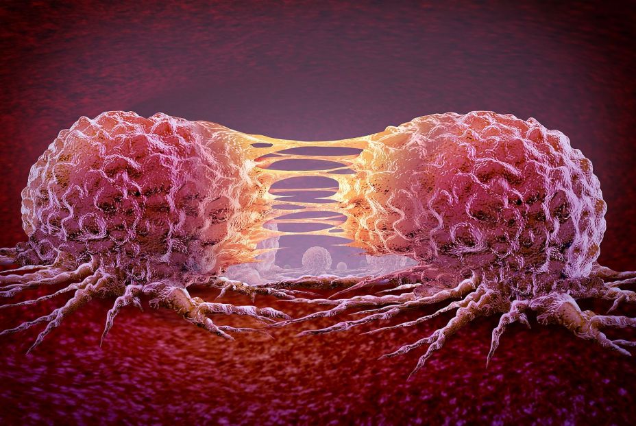 Ilustración de una célula metastásica. Bigstock . Ilustración de una célula metastásica. Bigstock .