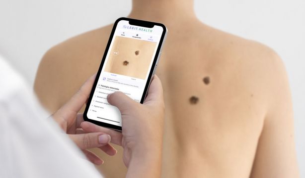 La IA puede ser la clave para la detección precoz del cáncer de piel: la razón