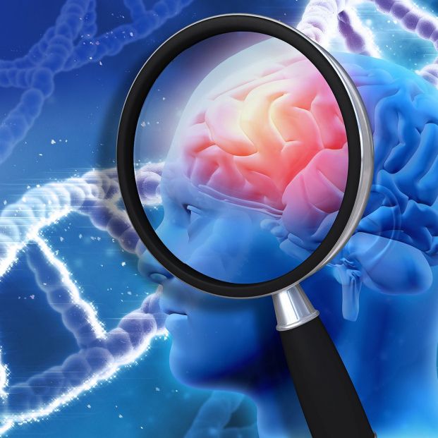 La proteína clave para frenar el alzhéimer. Bigstock