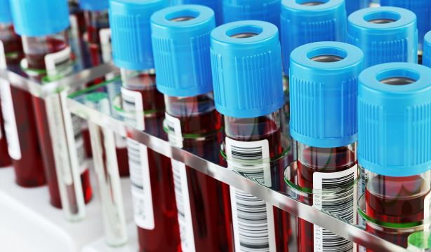 La nueva herramienta de evaluación de la salud que mide la edad biológica del cuerpo. Bigstock