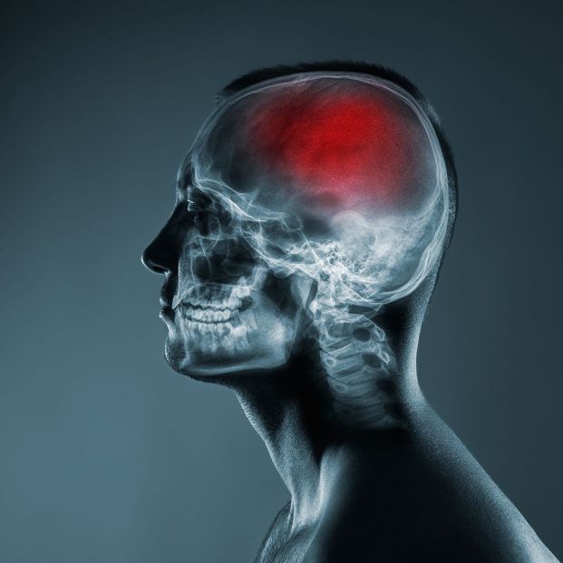 bigstock X ray Of A Mans Head Cerebral 402944414 bigstock X ray Of A Mans Head Cerebral 402944414