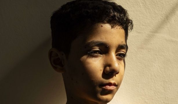 Esta es la foto ganadora del World Press Photo 2025