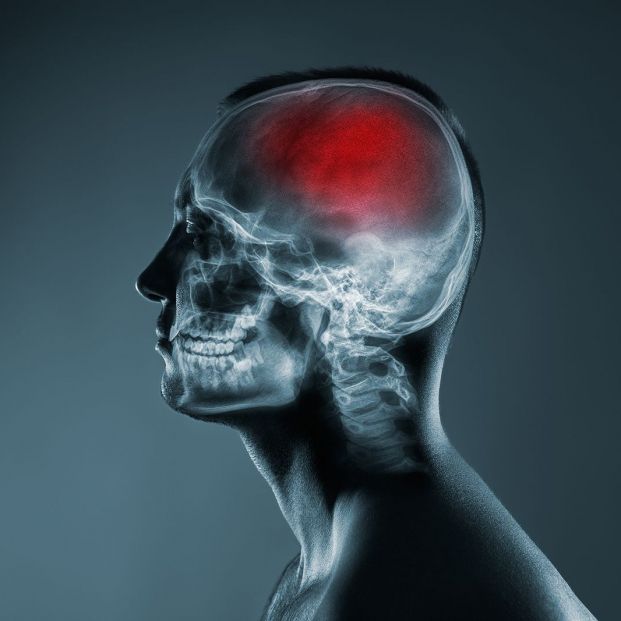 bigstock X ray Of A Mans Head Cerebral 402944414 (1)