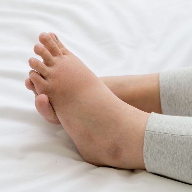 Por todos estos motivos se hinchan los pies Por todos estos motivos se hinchan los pies