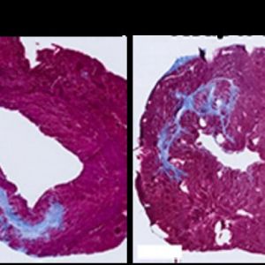 Comparación de células musculares cardíacas con y sin tratamiento. El daño celular se muestra en azul. Foto cedida por la Universidad de California en San Diego.low res Comparación de células musculares cardíacas con y sin tratamiento. El daño celular se muestra en azul. Foto cedida por la Universidad de California en San Diego.low res