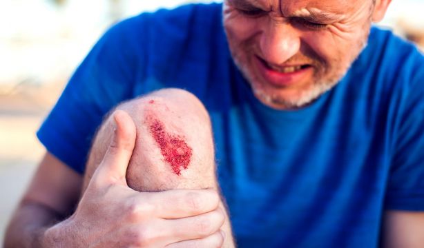 Ni alcohol ni agua oxigenada: un experto en primeros auxilios explica qué echar a una herida