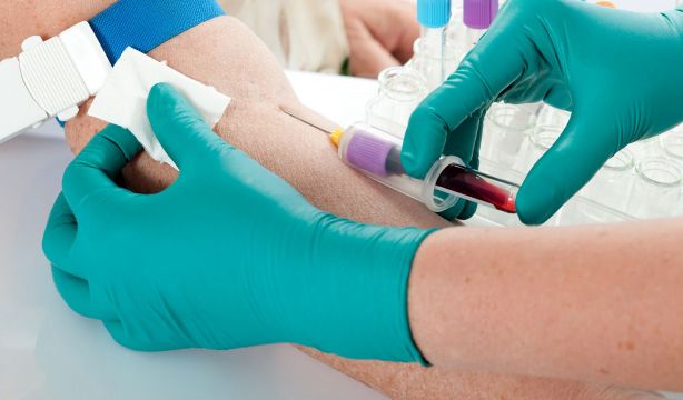 Cada vez más cerca el análisis de sangre para detectar el Parkinson. (Bigstock)