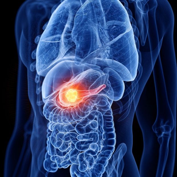 Descubren un mecanismo bacteriano capaz de destruir células tumorales