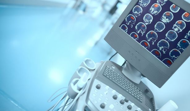 Qué es la terapia de estimulación craneal profunda para el párkinson recibida por Morten Harket