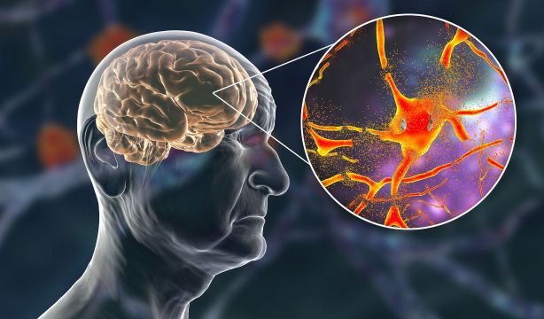 El papel protector de las moléculas de azúcar contra el envejecimiento cerebral (Bigstock)