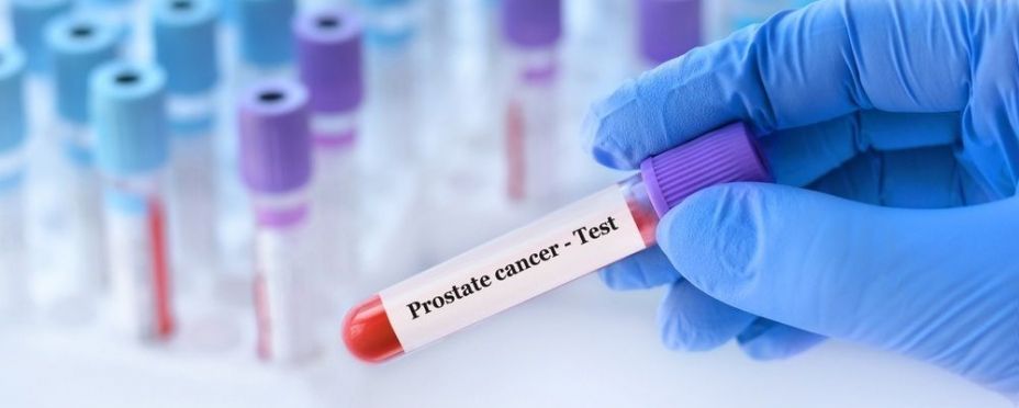 EuropaPress 6791098 urologa advierte dolor oseo hombres mayores senal silenciosa cancer EuropaPress 6791098 urologa advierte dolor oseo hombres mayores senal silenciosa cancer