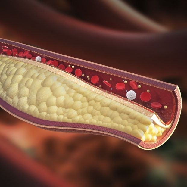EuropaPress. colesterol en sangre