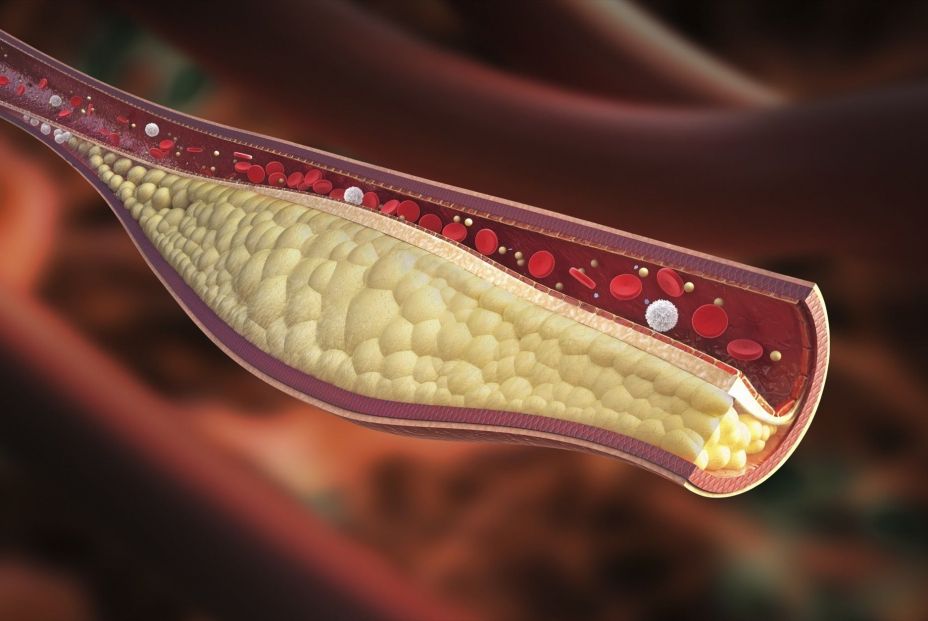 EuropaPress. colesterol en sangre