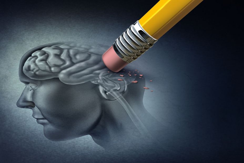 El Alzheimer se inicia 15 años antes en las personas con síndrome de Down