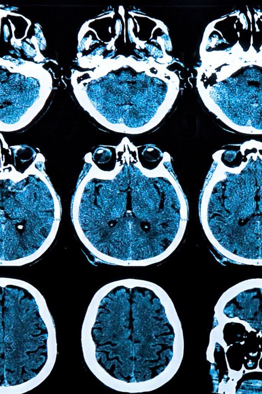 bigstock Mri Brain Scan 67656196 bigstock Mri Brain Scan 67656196