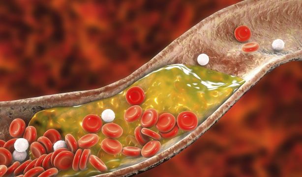 Desarrollan una nueva estrategia terapéutica para reducir los niveles de colesterol