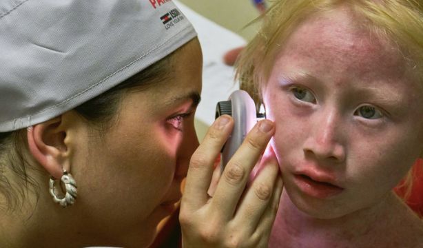 ISDIN atiende a más de cien personas con albinismo en Panamá para luchar contra el cáncer de piel