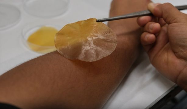 Crean un nuevo material que combate infecciones en la piel activado por el sol