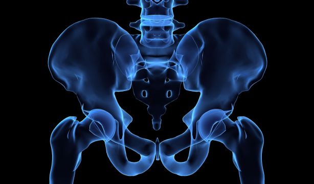 Estas son las diferencias radiológicas entre la artritis reumatoide y la artrosis. (Bigstock)