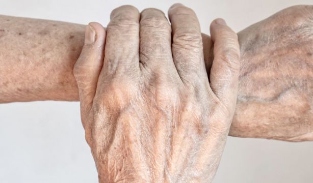 Identifican una pista clave en la mano para diagnosticar la artritis reumatoide de forma precoz