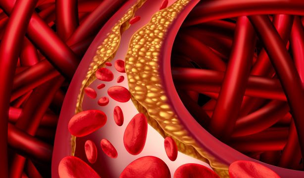 Descubren que una técnica de imagen podría ayudar a tratar la aterosclerosis