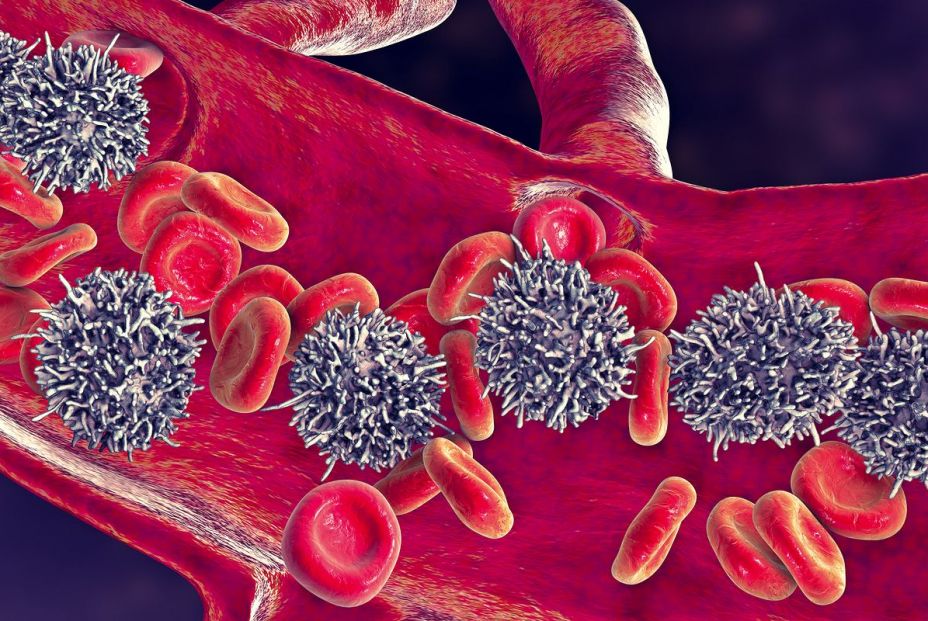 Investigadores españoles descifran la predisposición genética a la leucemia linfática