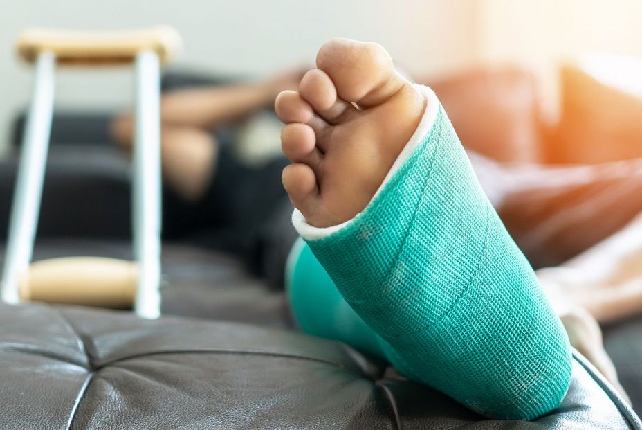 bigstock Bone Fracture Foot And Leg On308123317 bigstock Bone Fracture Foot And Leg On308123317