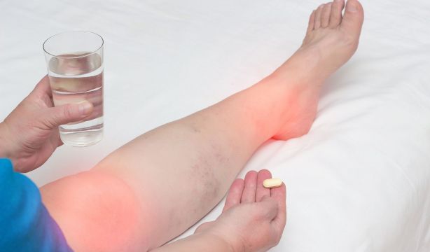 La OCU denuncia irregularidades en cuatro complementos alimenticios para la salud articular