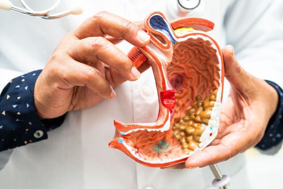 EuropaPress 6437632 imagen archivo representacion estomago EuropaPress 6437632 imagen archivo representacion estomago