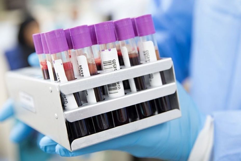 EuropaPress 6651255 analisis sangre foto recurso