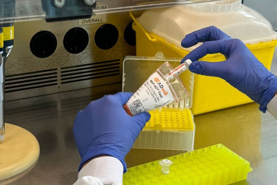 Desarrollan el primer biomarcador en sangre que anticipa el avance del alzhéimer Desarrollan el primer biomarcador en sangre que anticipa el avance del alzhéimer