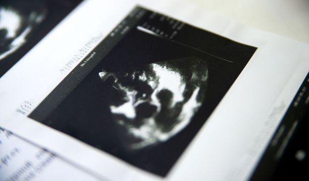 Identifican un biomarcador para evaluar la insuficiencia cardíaca por déficit de hierro. Fuente: bigstock.