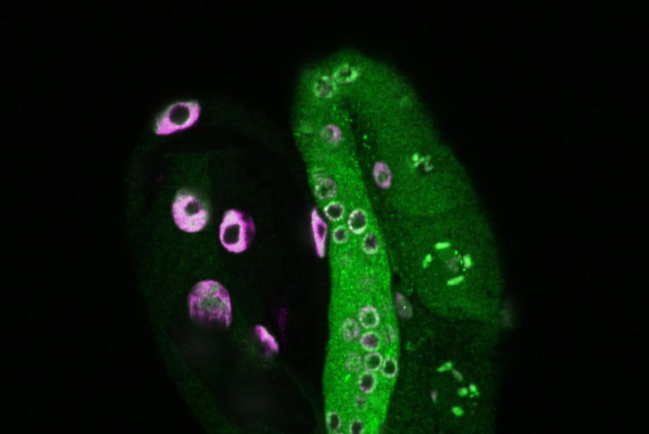 Histone2 (2) Histone2 (2)