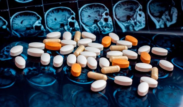 Donanemab, el fármaco que retrasa el alzhéimer, recibe la aprobación definitiva en Europa (Bigstock)