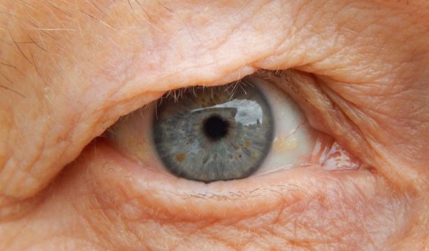 Estos son algunos posibles síntomas iniciales de la DMAE, una de las causas de ceguera más comunes