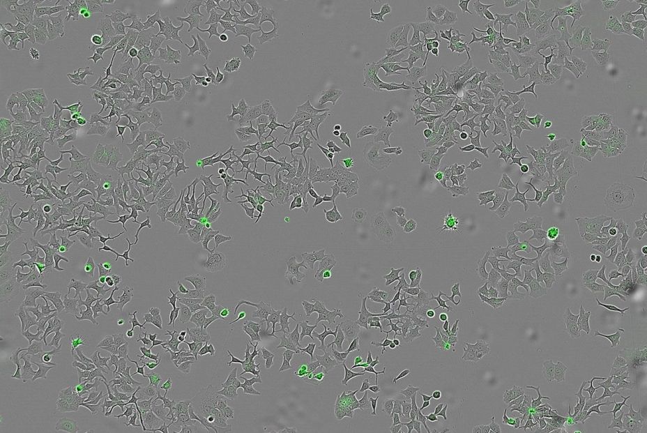 Descubren un mecanismo bacteriano capaz de destruir células tumorales