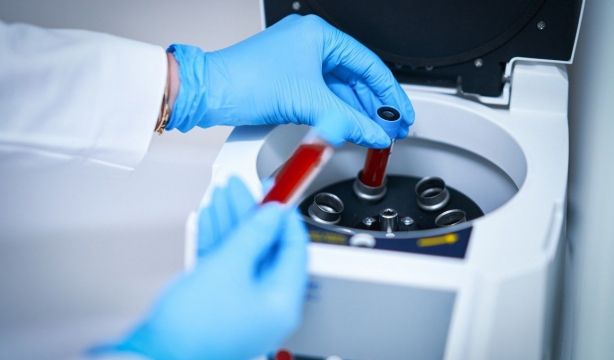 Un análisis de sangre podría detectar el párkinson antes de los primeros síntomas. Foto: Europa Press