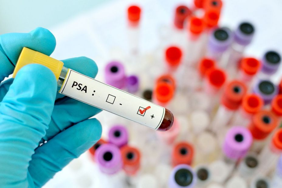 bigstock PSA positive 93905006 (4)