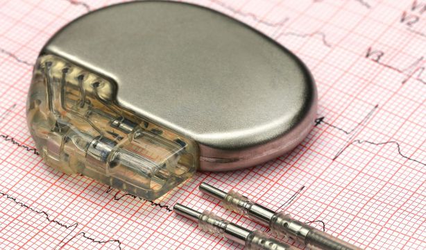 Aumento preocupante de las infecciones por implantes cardíacos o articulares. (Bigstock)