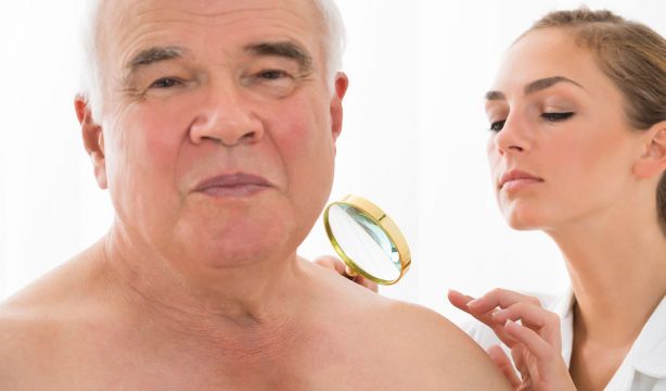 Un nuevo método identifica mejor a las personas con riesgo de sufrir cáncer de piel. (Bigstock)