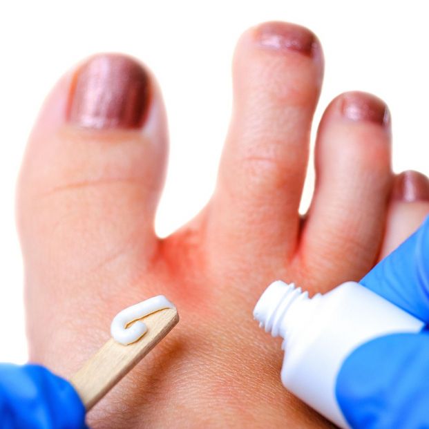 Cómo evitar los sabañones en los pies