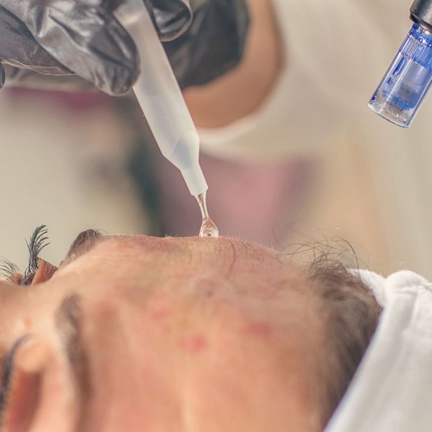 Se puede eliminar una cicatriz para siempre (Bigstock)