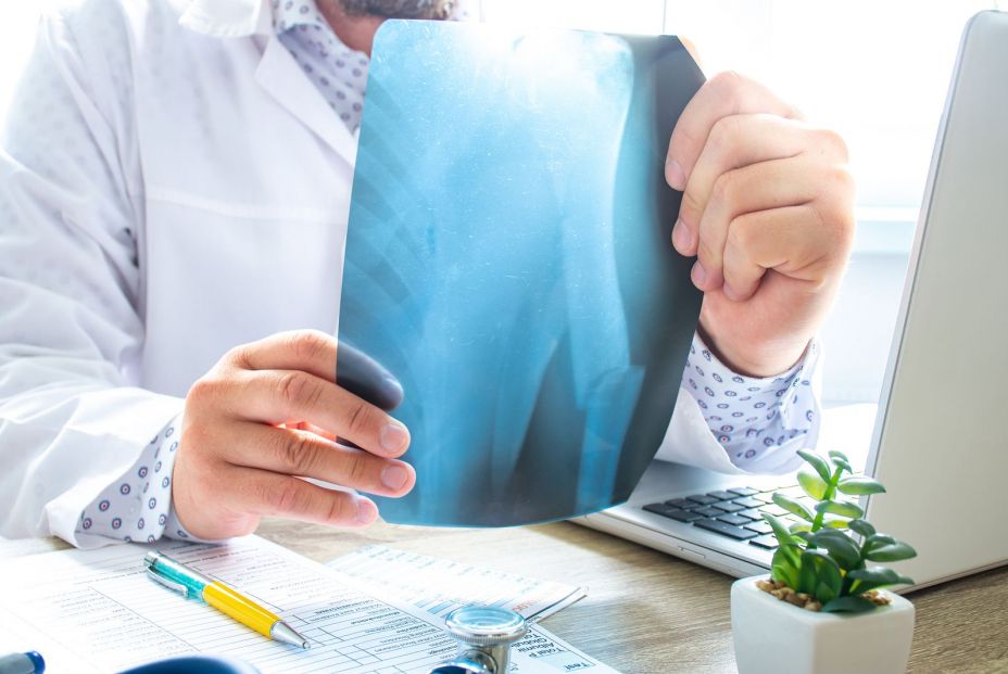 El 65% de las mujeres con fractura por fragilidad en España no estaban diagnosticadas de osteoporosis . El 65% de las mujeres con fractura por fragilidad en España no estaban diagnosticadas de osteoporosis .