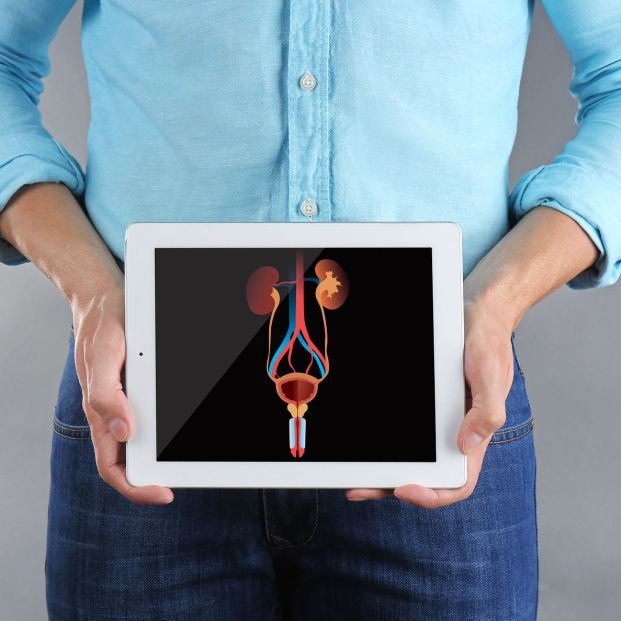 Estenosis uretral (bigstock)