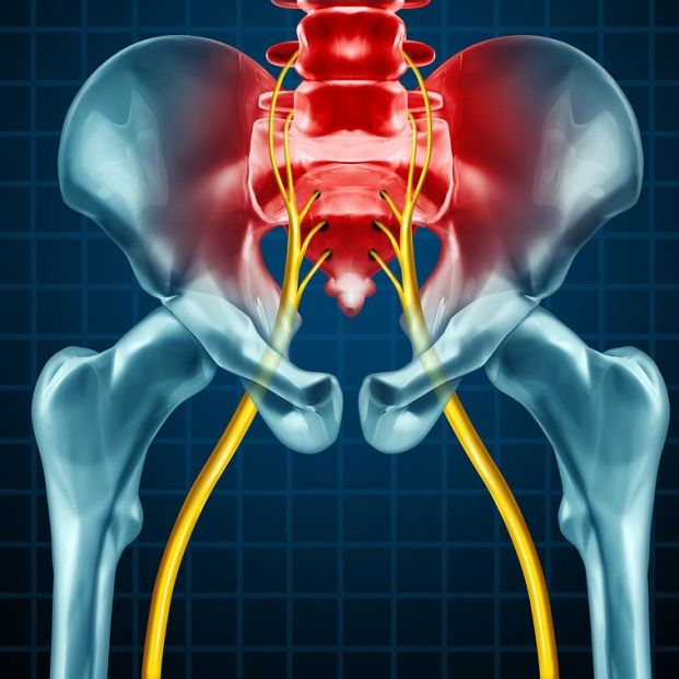 Dolor en el nervio ciático Dolor en el nervio ciático