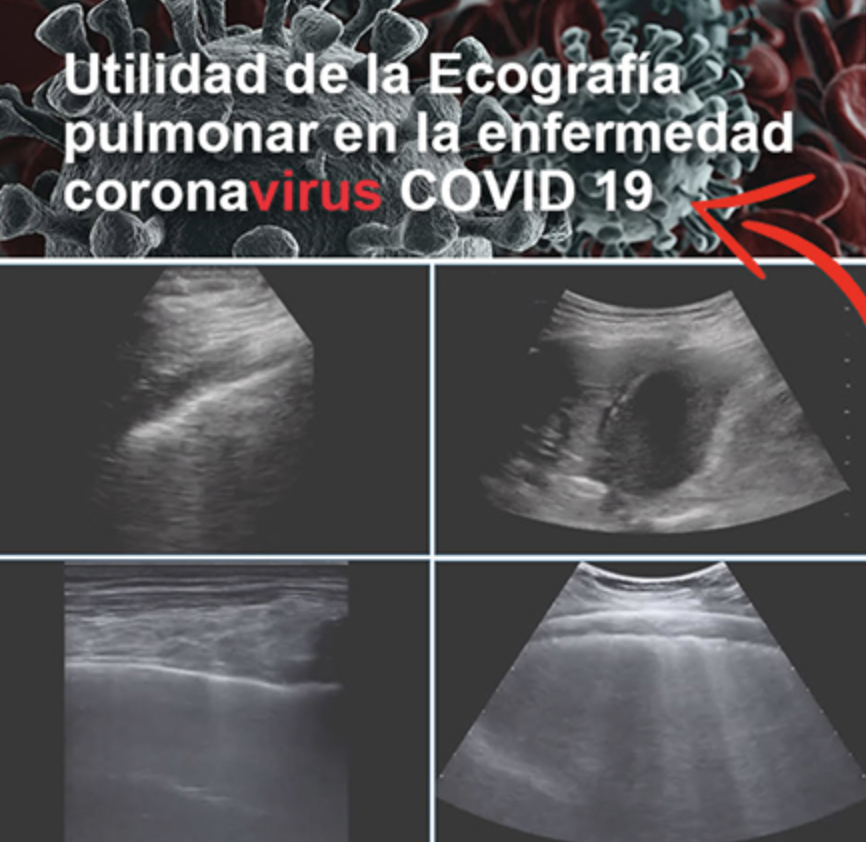 Ecografías contra el Covid-19 Ecografías contra el Covid-19