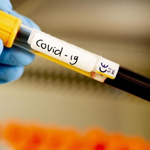 Test Covid 19. EuropaPress Test Covid 19. EuropaPress