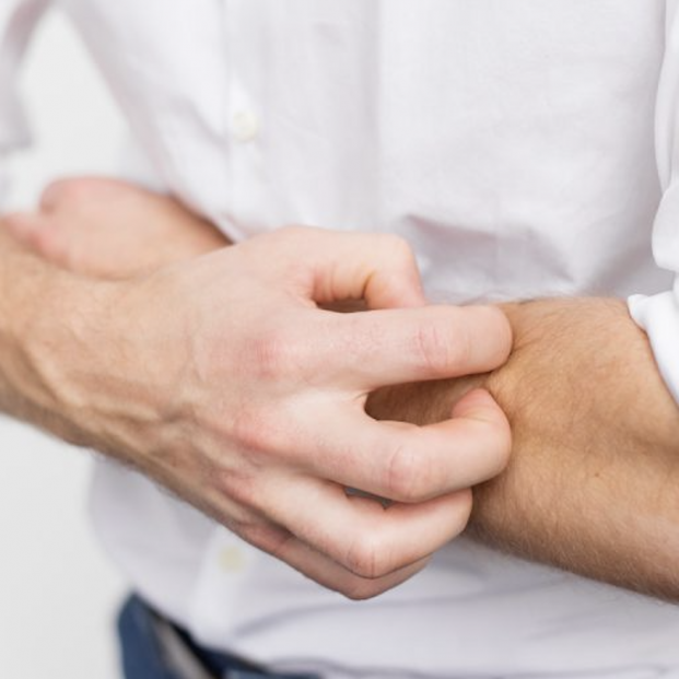 Descubiertos cinco grandes tipos de lesiones cutáneas en pacientes con coronavirus Descubiertos cinco grandes tipos de lesiones cutáneas en pacientes con coronavirus